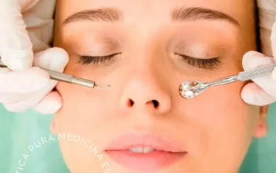 Tendencias en Estética Facial: Descubre el Microneedling y la Higiene Facial Profunda en Córdoba Estética