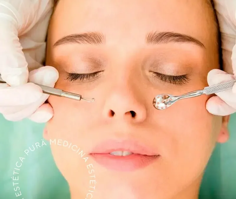 Tendencias en Estética Facial: Descubre el Microneedling y la Higiene Facial Profunda en Córdoba Estética